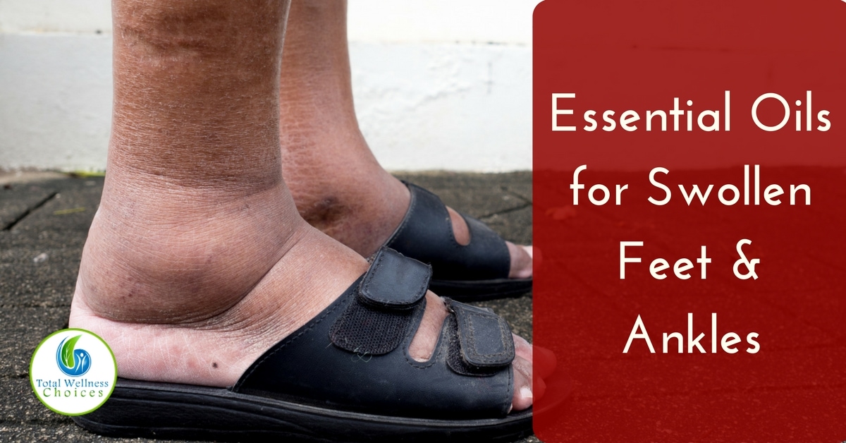 Top 5 Essential Oils For Swollen Feet And Ankles To Reduce Swelling